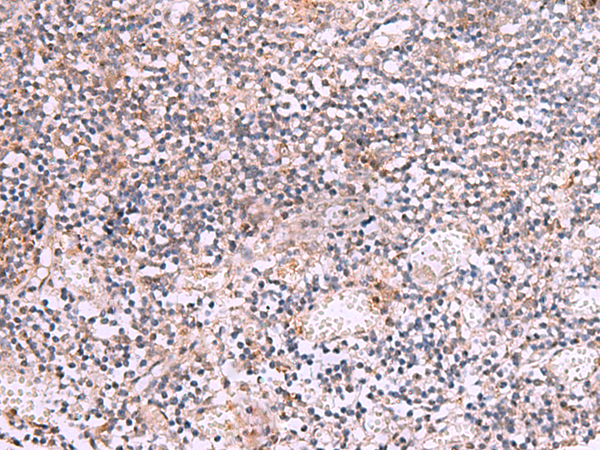 TUBB2A Antibody