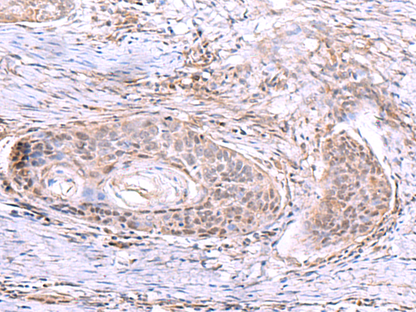 AKAP17A Antibody