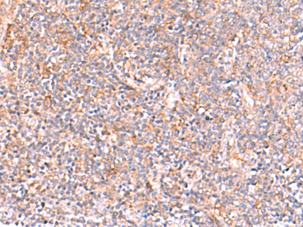 NADK Antibody