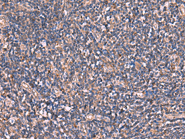 TTC38 Antibody