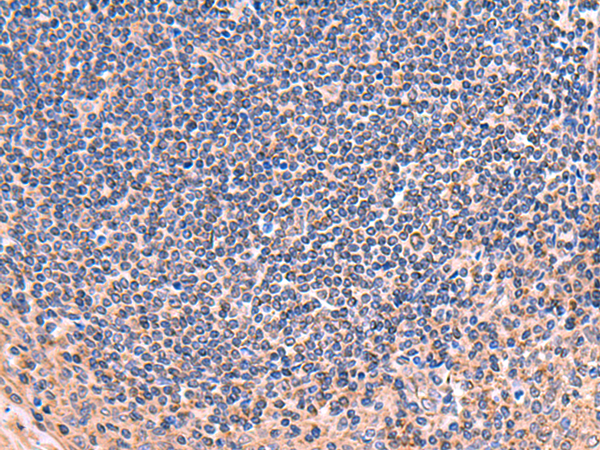 ZNF256 Antibody