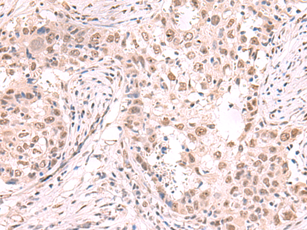 ZNF559 Antibody
