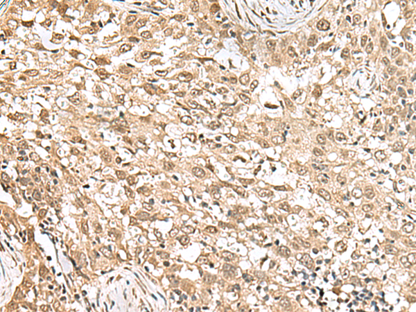 RPS6KA5 Antibody