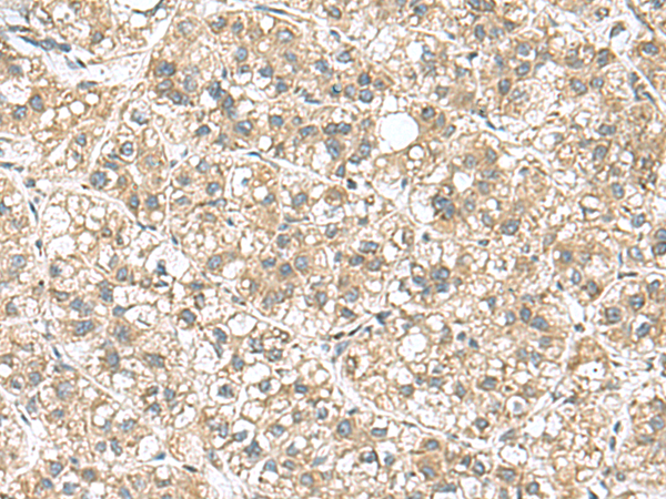 PAPSS2 Antibody