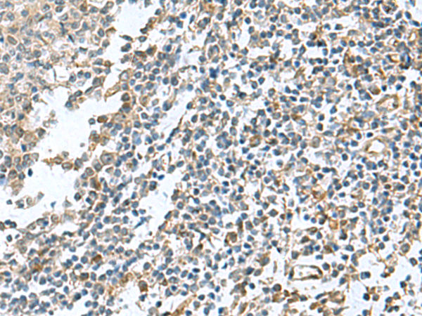 PAPSS2 Antibody