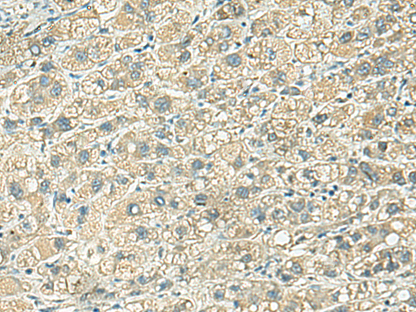 KLC2 Antibody