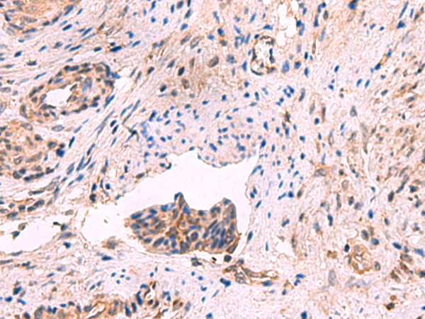 GSPT2 Antibody