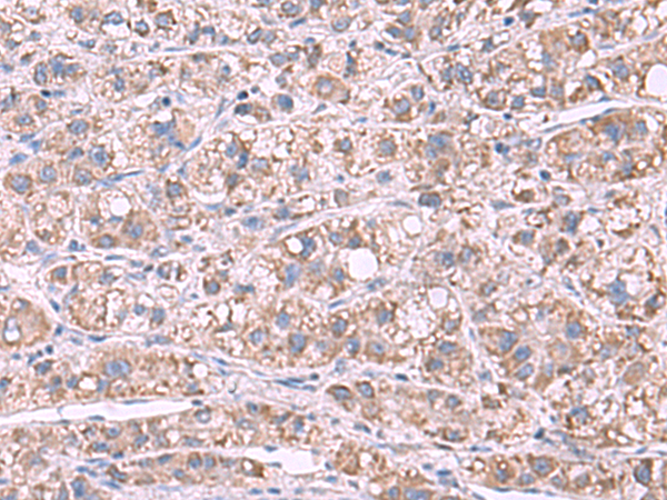 GSTCD Antibody
