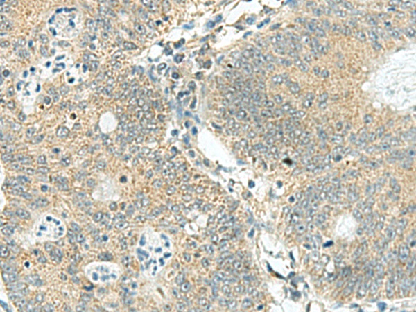 SORBS2 Antibody
