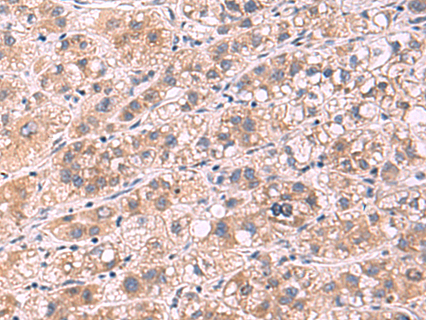 PPEF1 Antibody