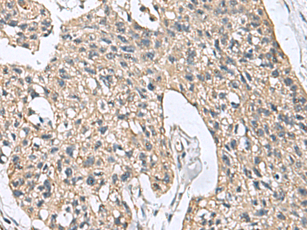 DPY19L3 Antibody