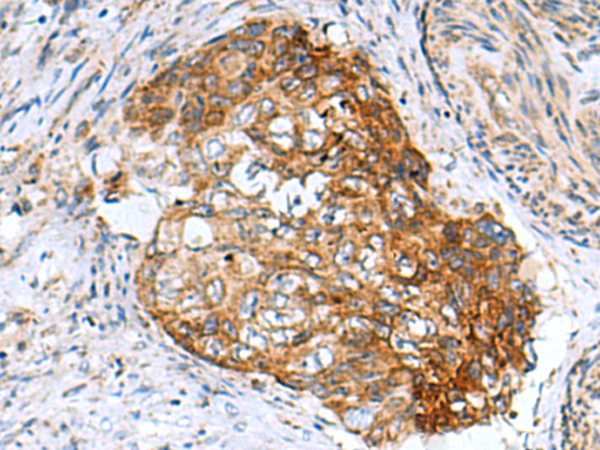 AP1S3 Antibody