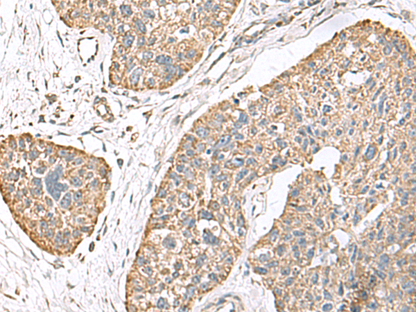 TMEM141 Antibody