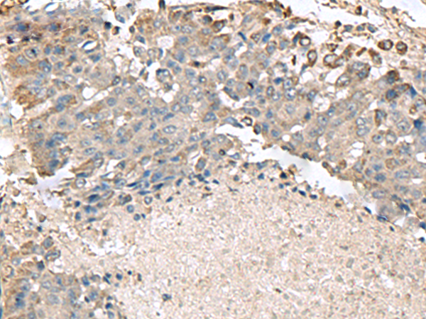 TMEM141 Antibody