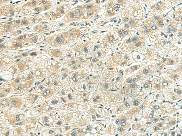 RHBDL2 Antibody