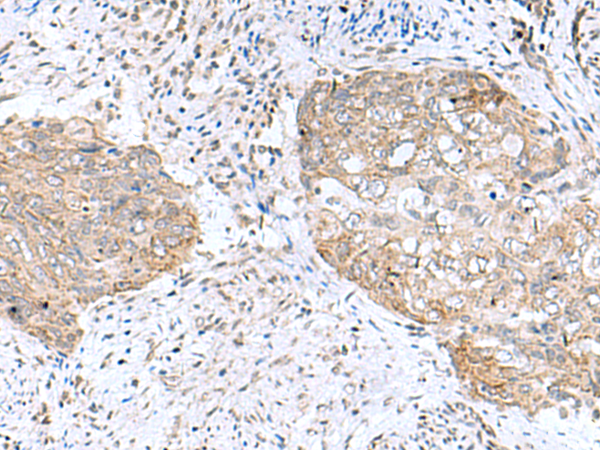 PAM16 Antibody