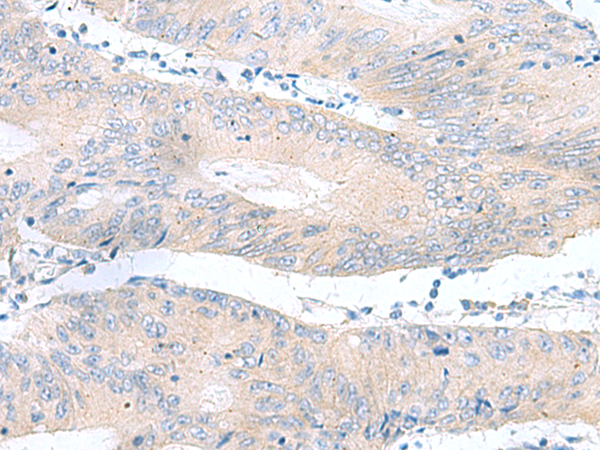RPS16 Antibody