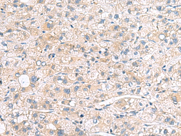 MYL1 Antibody