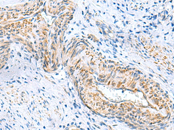 MYL1 Antibody