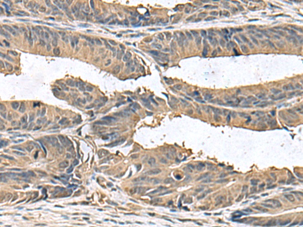 ZG16 Antibody