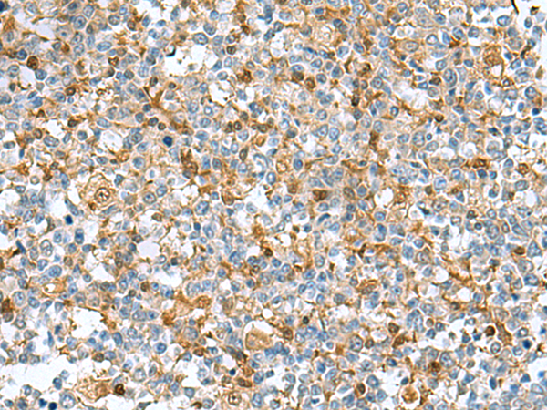 DNPH1 Antibody