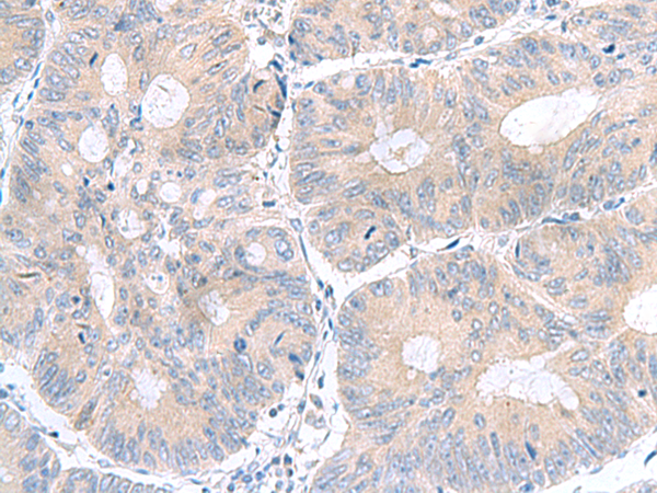UBE2F Antibody