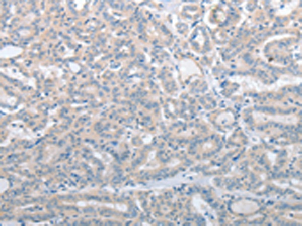SLC17A6 Antibody