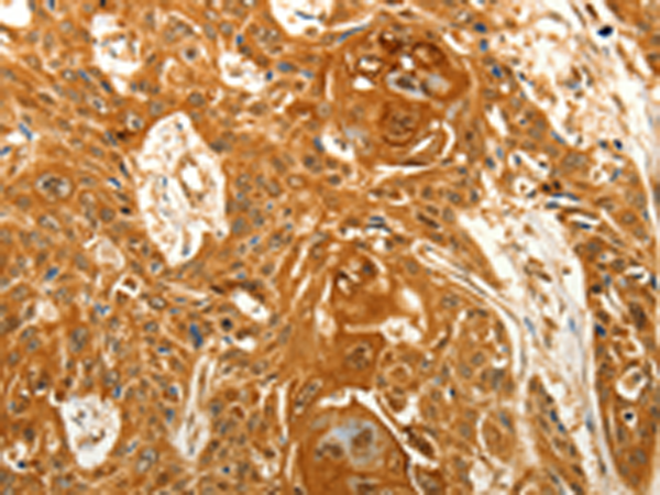 VSNL1 Antibody