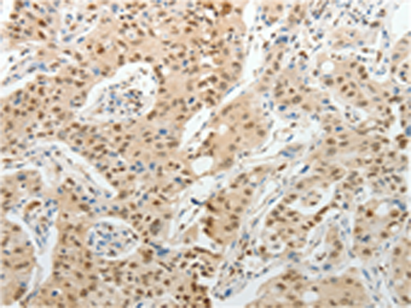 UNC5CL Antibody