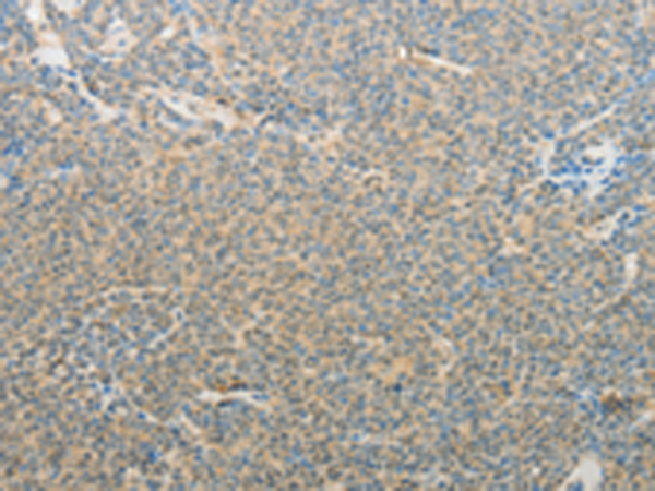 XPNPEP3 Antibody
