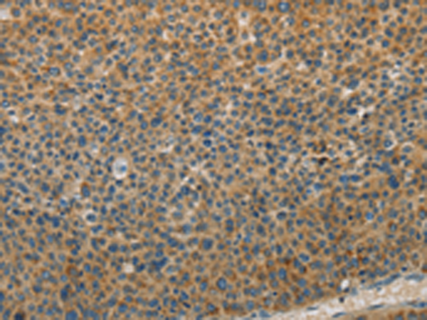 WBP2 Antibody
