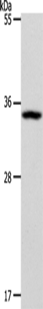 WBSCR22 Antibody