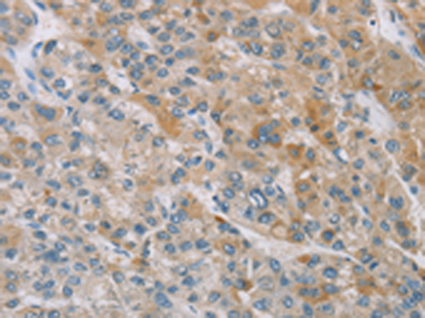 ZAK Antibody