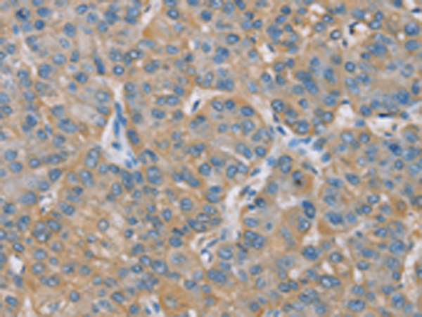 ZBTB3 Antibody