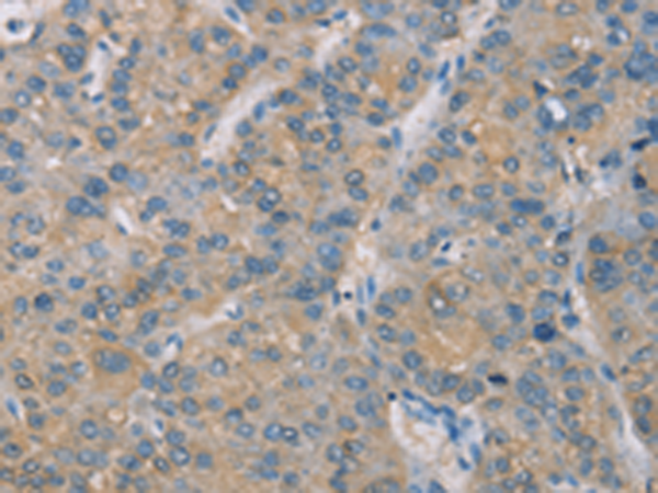 ZBTB6 Antibody