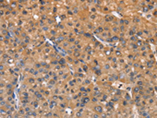 ZFP64 Antibody