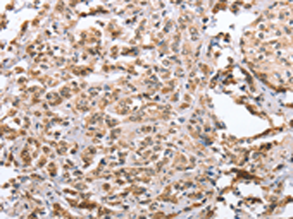 ZFYVE16 Antibody