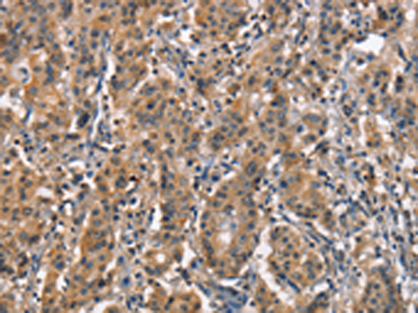 ZGPAT Antibody