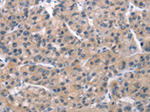 ZGPAT Antibody