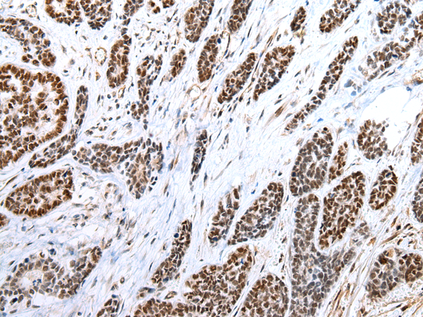 FOXP1  Antibody