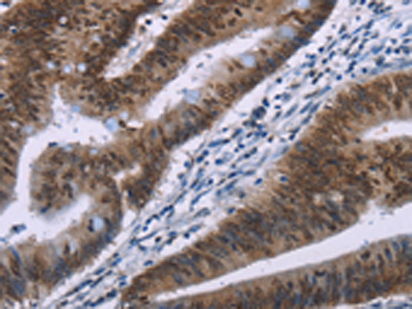 HMGA1  Antibody
