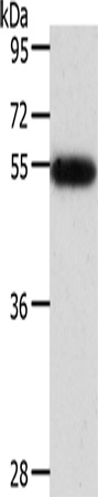 AGT/Angiotensin-1 Antibody