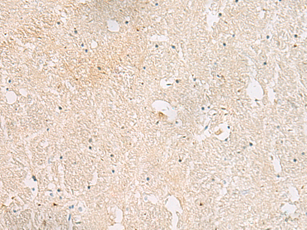 AKAP3 Antibody