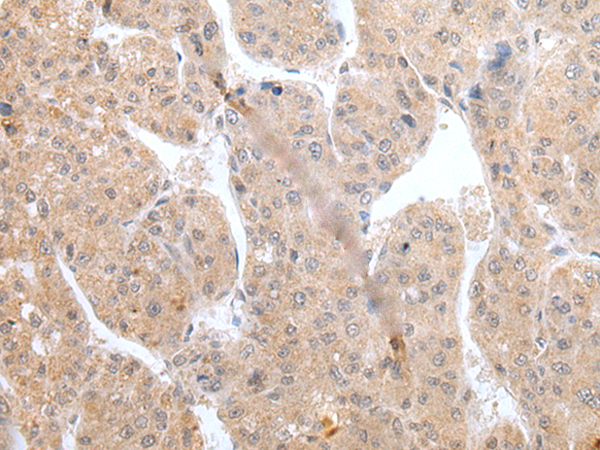 KCNB1 Antibody