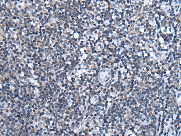 CHD3 Antibody
