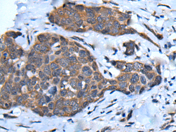 CHD3 Antibody