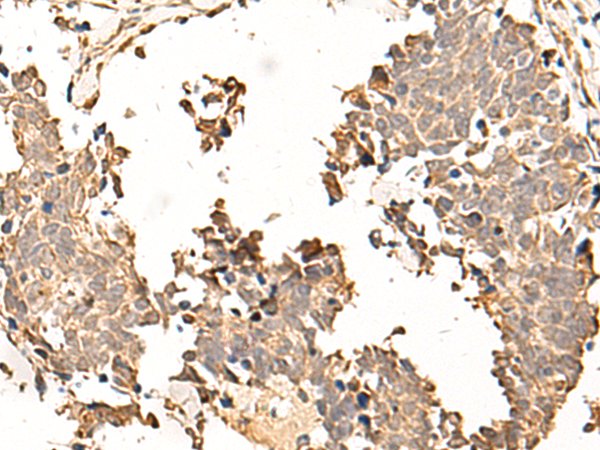 SOX3 Antibody
