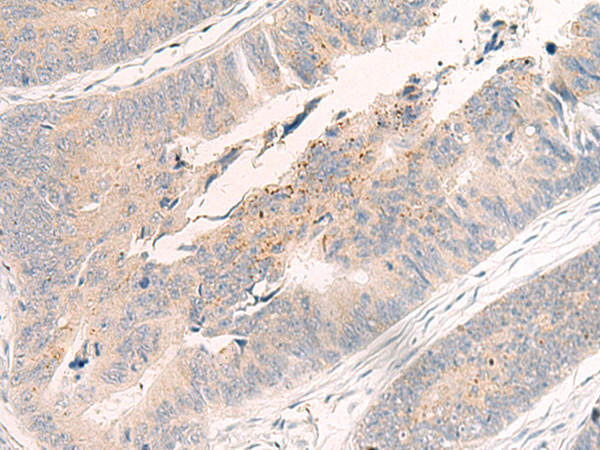WNK4 Antibody