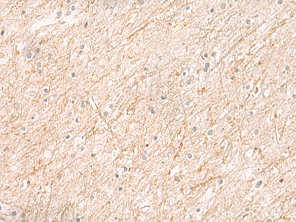 CLDN16 Antibody