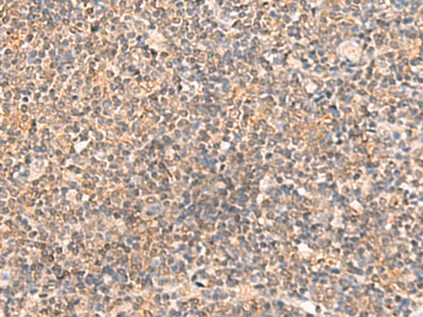 ABCB4 Antibody